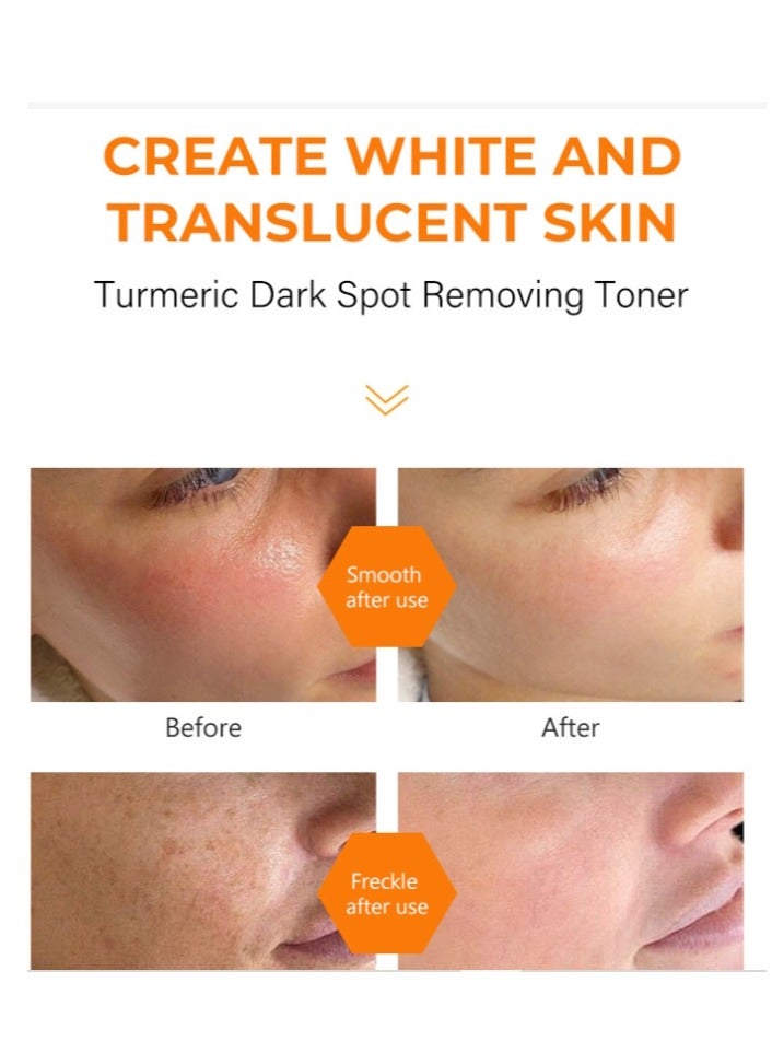 MOOYAM Turmeric Dark Spot Corrector Toner 100ML Facial Toner For Acne Prone Skin Dark Spot Remover For Face Hydrating Face Toner For Women Treatment  - Image 5