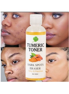 MOOYAM Turmeric Dark Spot Corrector Toner 100ML Facial Toner For Acne Prone Skin Dark Spot Remover For Face Hydrating Face Toner For Women Treatment  - Image 1