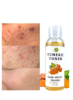 MOOYAM Turmeric Dark Spot Corrector Toner 100ML Facial Toner For Acne Prone Skin Dark Spot Remover For Face Hydrating Face Toner For Women Treatment  - Image 2