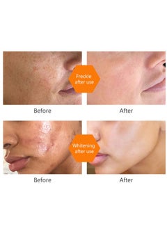 MOOYAM Turmeric Dark Spot Corrector Toner 100ML Facial Toner For Acne Prone Skin Dark Spot Remover For Face Hydrating Face Toner For Women Treatment  - Image 4