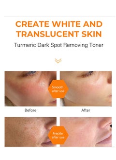 Turmeric Dark Spot Corrector Toner 100ML Facial Toner For Acne Prone Skin Dark Spot Remover For Face Hydrating Face Toner For Women Treatment - pzsku/ZA8EC69B094836D3E101FZ/45/_/1733842656/a5e9f36b-f73c-47ab-8935-e693d8c5bb88