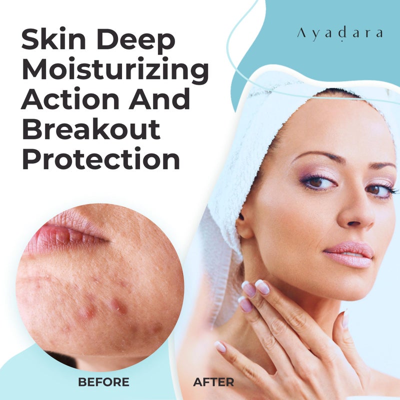 AYADARA Moisturizing Acne Cream, Salicylic Acid Face Moisturizer for Oily & Acne-Prone Skin, Helps with Pimples, Blackheads, Whiteheads, Hormonal & Cystic Acne, for Men and Women, 90-Day Supply by Ayadara - Image 2