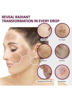 7 Days Serum For Pigmentation & Dark Spots Removal Antipigmentation Face Serum For Men & Women With Hyaluronic Acid To Remove Blemishes Acne Marks & Tanning 30 Ml  - Image 2