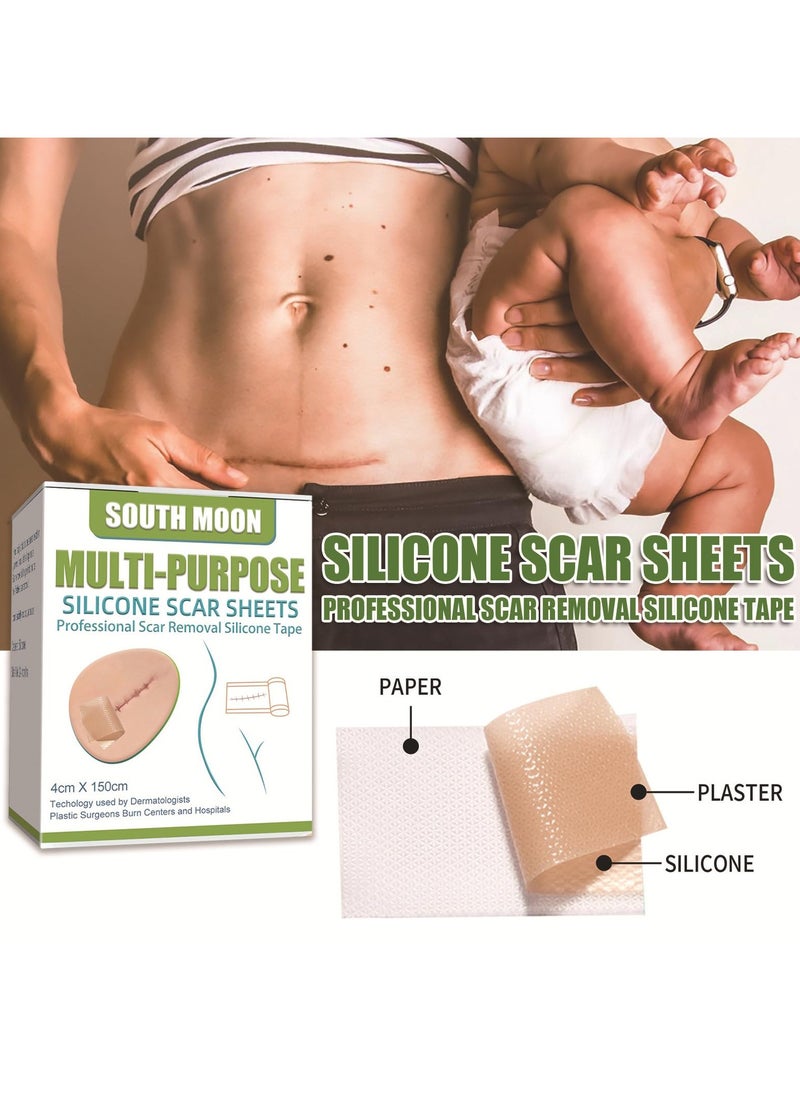 SOUTH MOON - Silicone Scar Patch, Fade Scar Sticker, Efficient Beauty Scars Removal Cesarean Section Burn Scars Left Behind Gel Painless Tape Roll (4cm * 1.5m) - Image 1