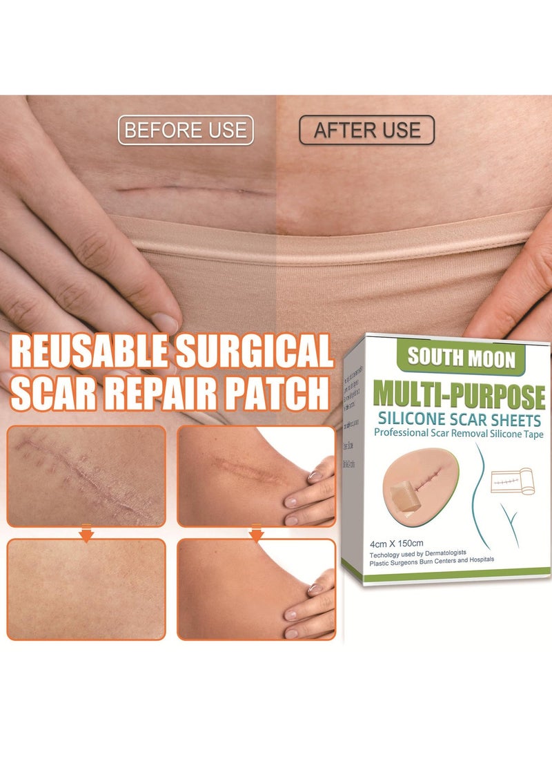 SOUTH MOON - Silicone Scar Patch, Fade Scar Sticker, Efficient Beauty Scars Removal Cesarean Section Burn Scars Left Behind Gel Painless Tape Roll (4cm * 1.5m) - Image 1