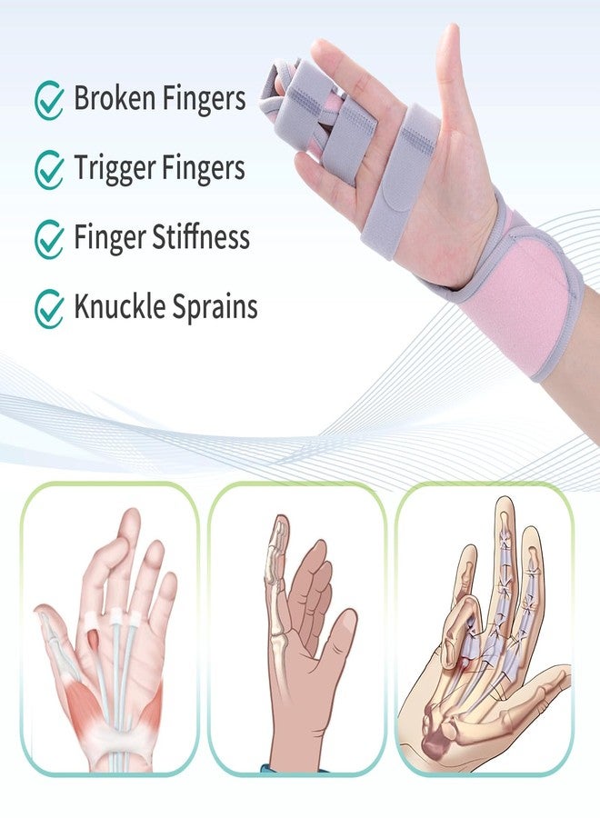Lefeke Trigger Finger Splint, Finger Brace for Middle, Index, Pinky, or Ring Finger Support, Hand Splint for Broken Fingers, Arthritis, Fracture, Hand Brace with Fingers Support (2 fingers Fixed) Pink - Image 2