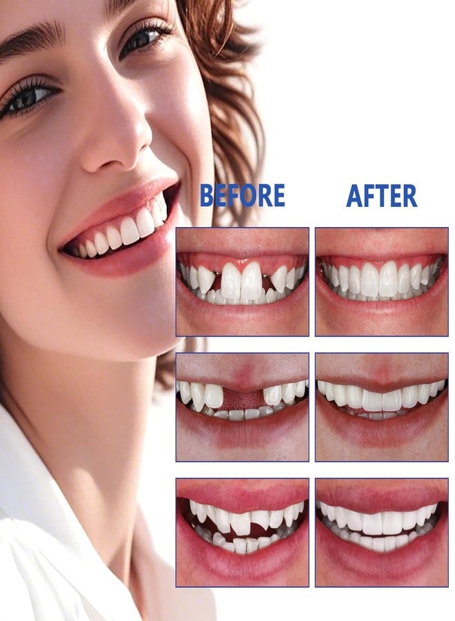 DWFKHT Tooth Repair Kit, Moldable False Teeth, Tooth Replacement Missing Teeth, Teeth Filling Kit Permanent with Tool, Tooth Repair Kit for Broken Teeth, Temporary Tooth Filling Kit, Moldable Teeth（50ML） - Image 5