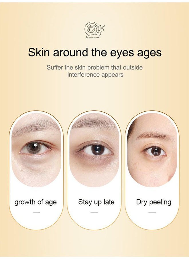 SADOER - Snail Essence Moisturize Eye Cream 20g, Anti Aging, Exquisitely Repair Skin, Moisturize, Fade Eye Lines, Dark Circles and Black Spots, Shrink Pores and Tighten Skin, Moisturizing Eye Serum, Eye Care - Image 1