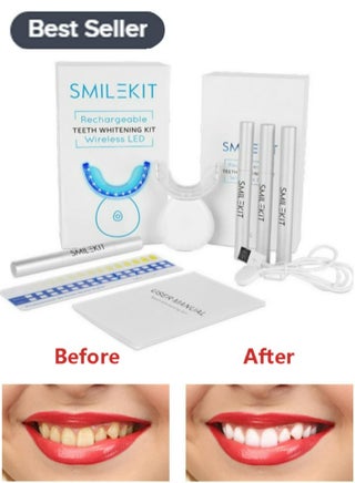 Teeth Whitening Kit, Suitable For Sensitive Teeth Gums Braces Care - pzsku/ZA9123D6F8EFA236A956BZ/45/_/1699154698/b6460573-3782-473c-9654-e3230198c71e