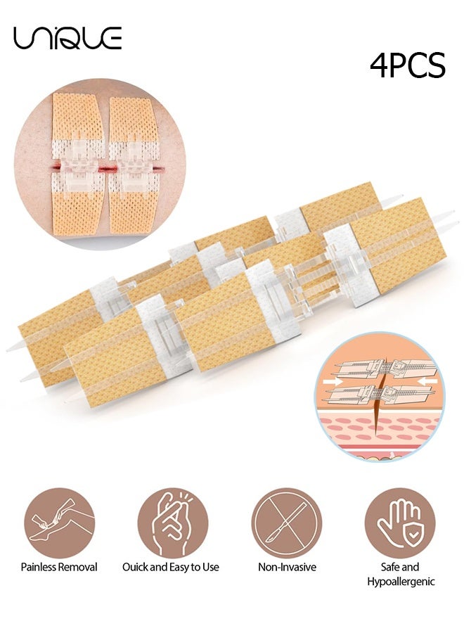 Unique 4 Pcs Zip Stitch Wound Closure Strips Kit - Emergency Zipstitch Laceration Kit Bandages - Adjustable - Repair Wounds Without Stitches - Suture-Free Surgical Repairment - for Wound Care First Aid、Hiking Camping Survival Outdoor - Painless Wound Repair Kit - Image 1