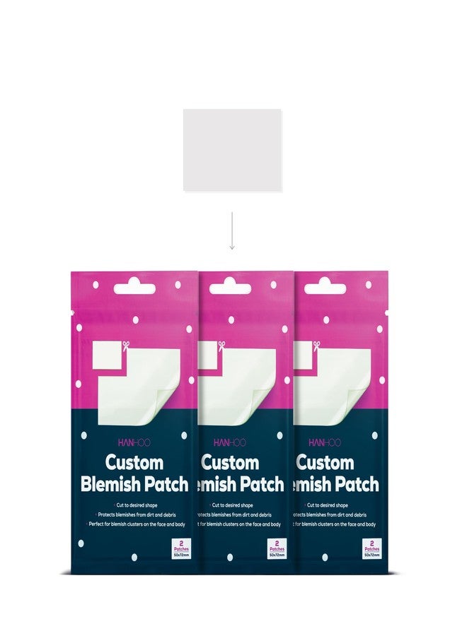 HANHOO Custom Body and Face Blemish Patch | Designed for Cluster Acne | Reduce Blemishes and Promotes healing | Hydrocolloid Skin Protection (6 Patch Count) - Image 1