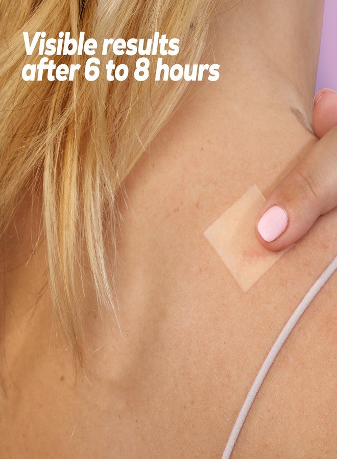 HANHOO Custom Body and Face Blemish Patch | Designed for Cluster Acne | Reduce Blemishes and Promotes healing | Hydrocolloid Skin Protection (6 Patch Count) - Image 5
