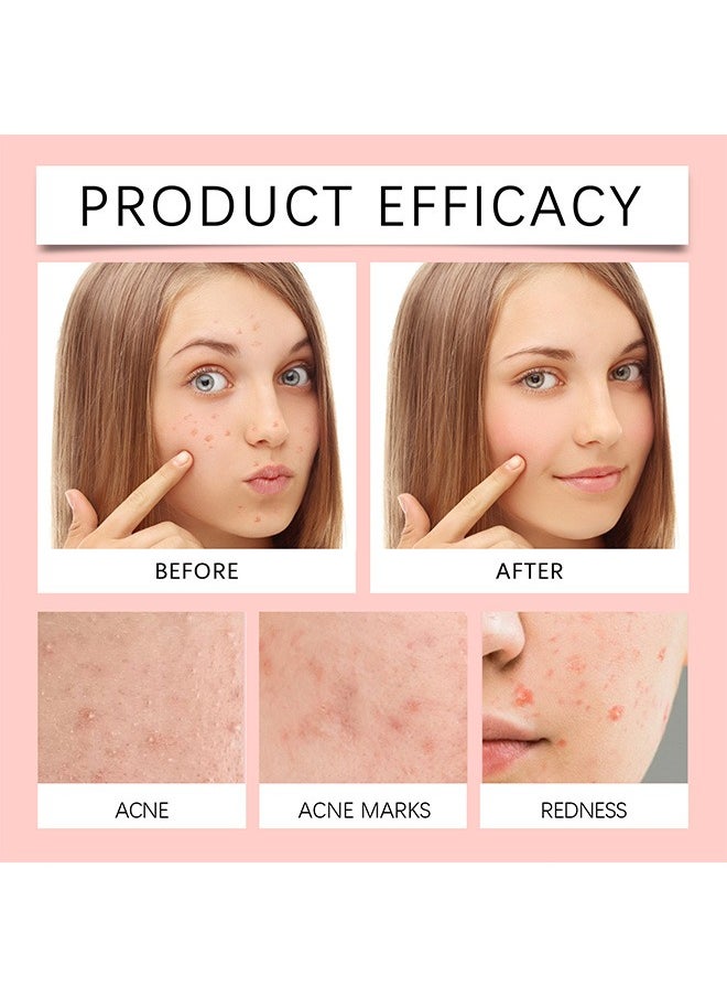 Invisible Acne Pimple Patch Set, Ultra Thin Hydrocolloid Acne Patch for Face, Salicylic Spot Cover