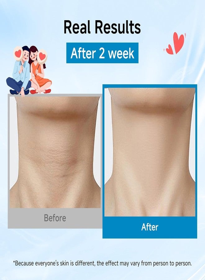 YUDDHAV FACE MASK & NECK MASK 2 PCS , Hydrolyzed Collagen NECK MASK Set with FACE MASK Hyaluronic Acid & Peptide,Moisturizing Firming Masks for Crepey Skin, Helps Reduce the Appearance of Fine Lines for Smoother-Looking Skin - Image 4
