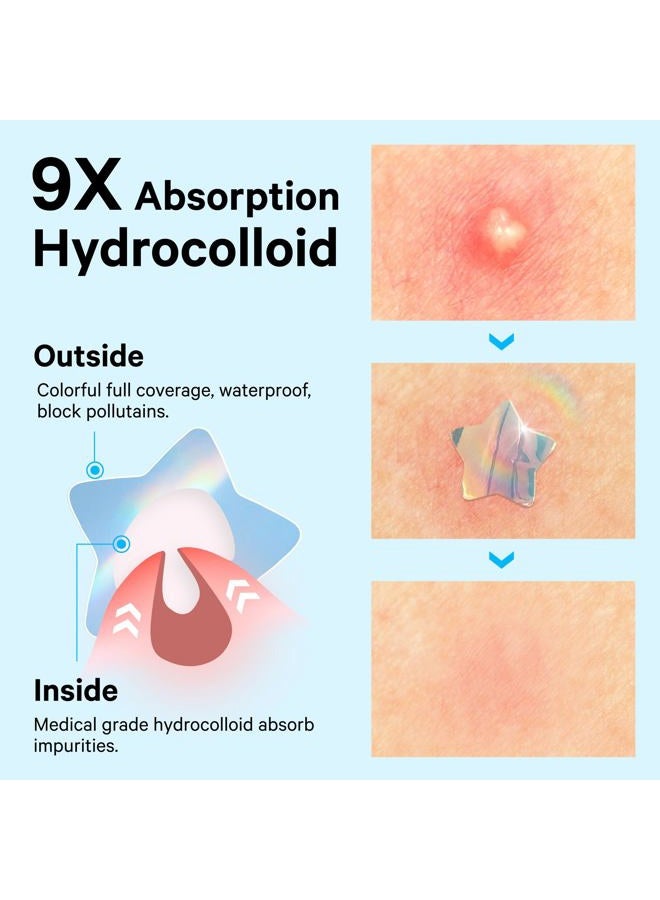 Sosky Pimple patches blue star cloud butterfly 12MM 36PCS Hologram - Image 3