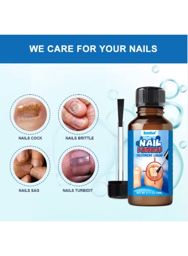 Sumifun Fungal Nail Treatment Liquid Nail Fungus Treatment for Toenails & Fingernails Fungal Nail Renewal Anti Fungus Nail Repair Smooth & Hydrates Nail Reduce Discoloration 30ml - Image 4