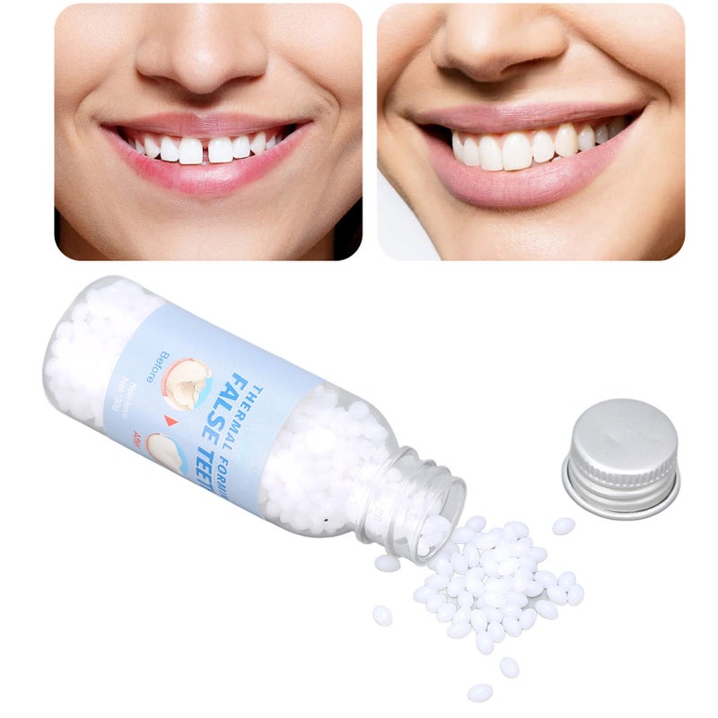 Tooth Repair Glue Safe Material Simple Operation Dental Care Glue Kit for Dental Restoration - Image 4