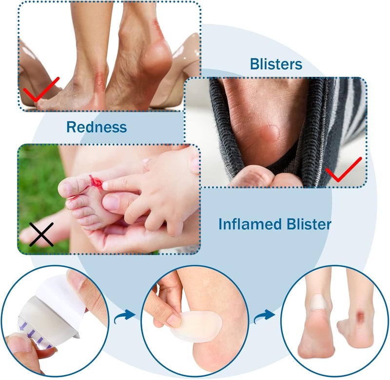 Tarpop 100 Pcs Blister Bandages Hydrocolloid Blister Pads for Heel Waterproof Gel Adhesive Bandages Protectors for Feet ToesRich Style - Image 4