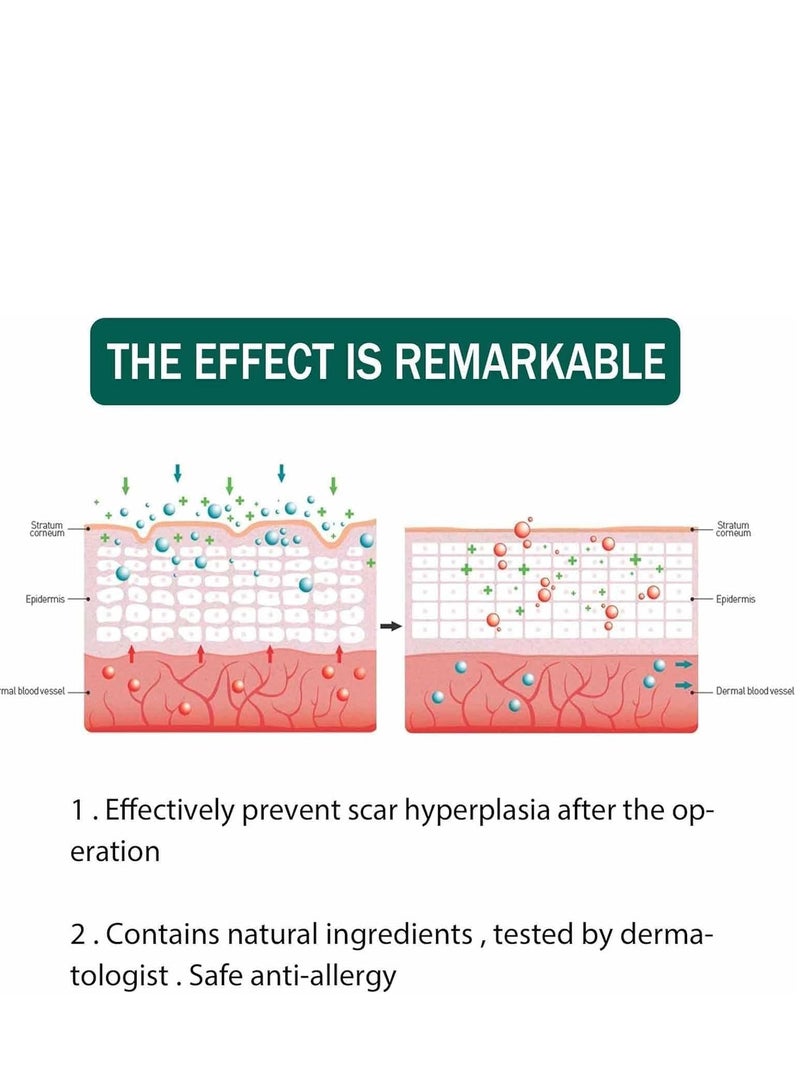 EELHOE Scar Repair Serum, Scar Removal Oil with Natural Ingredients, Suitable for Surgical Scars, C-Section, Stretch Marks, Acne, Injury, Burns, Keloids, Old and New Scars 30ml - Image 4