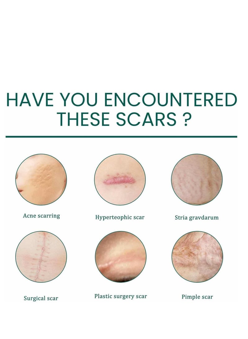 EELHOE Scar Repair Serum, Scar Removal Oil with Natural Ingredients, Suitable for Surgical Scars, C-Section, Stretch Marks, Acne, Injury, Burns, Keloids, Old and New Scars 30ml - Image 5