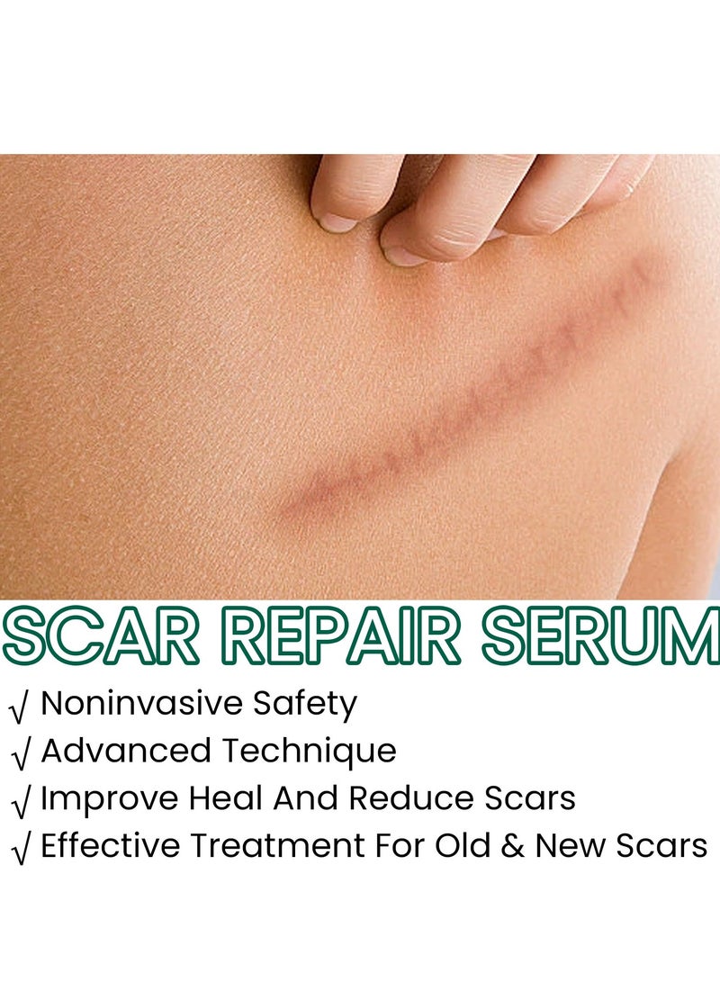 EELHOE Scar Repair Serum, Scar Removal Oil with Natural Ingredients, Suitable for Surgical Scars, C-Section, Stretch Marks, Acne, Injury, Burns, Keloids, Old and New Scars 30ml - Image 2
