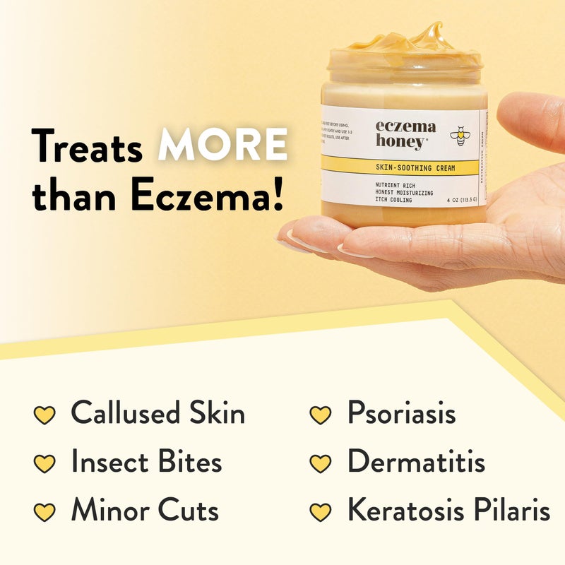 ECZEMA HONEY كريم العسل الأصلي لتهدئة البشرة - علاج الإكزيما العضوي لليدين والجسم - لوشن العسل الطبيعي للبشرة الجافة والحكة والمتهيجة (4 أونصات) - Image 5