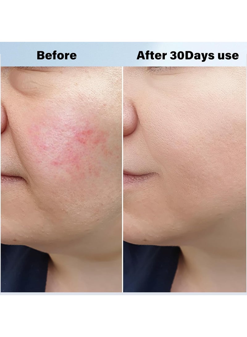 general Warm and cold firming device, vibrating light facial tool, electric skin care set, 8-21°C cold, 38-47°C hot facial massager - Image 3