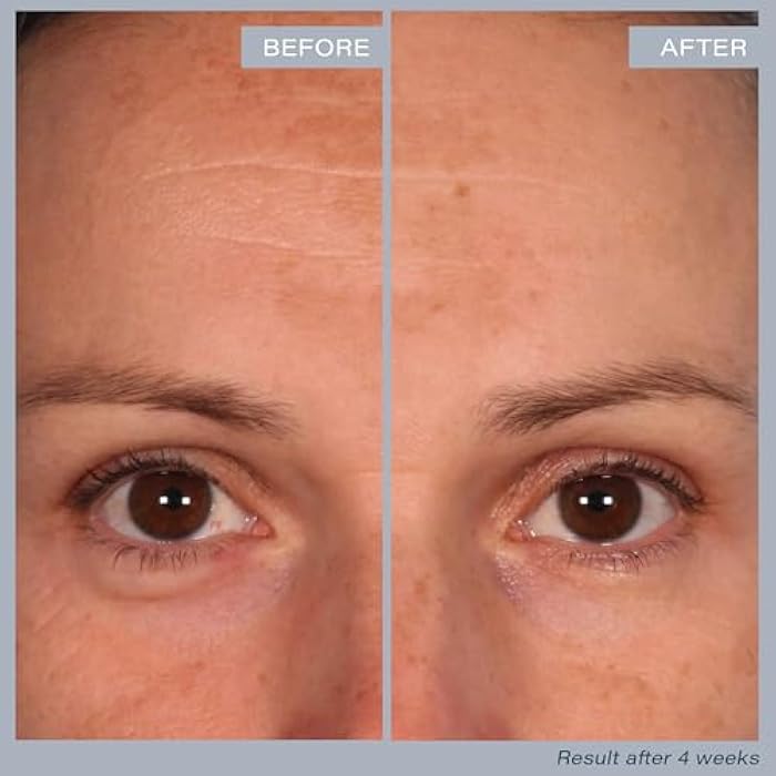 SKINN Multi-Acid Resurfacing Pads, with Glycolic, Lactic & Salicylic Acid, 60 Pads - Witch Hazel Chemical Peel for Face, Neck & Decollete Exfoliates, Brightens & Tones Skin, for Fine Lines & Wrinkles - Image 3