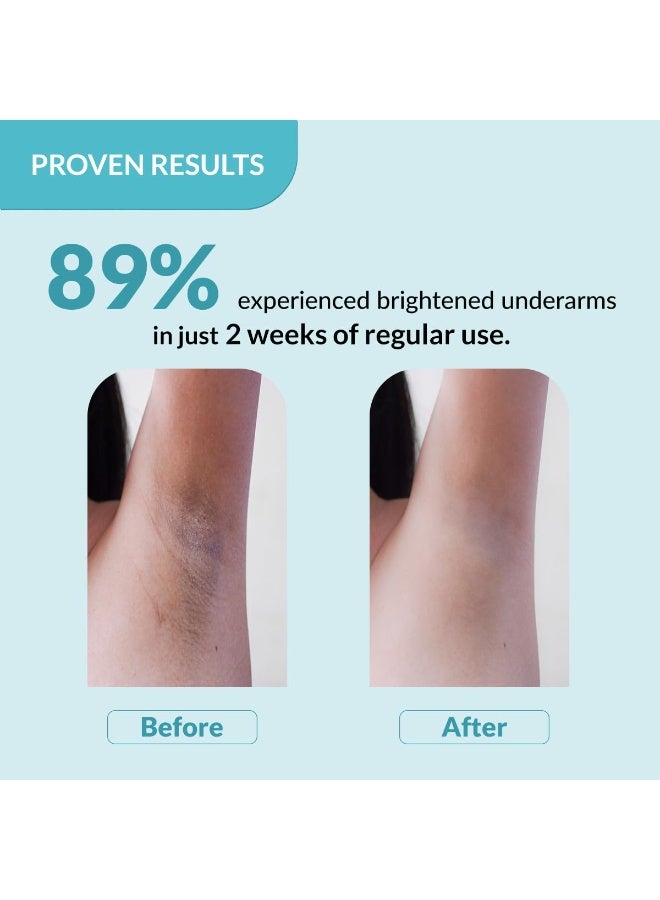 Fixderma Nigrifix Underarm Roll on with 6% AHA, Lactic Acid & 1% Mandelic Acid & Kojic Acid | Brightens Skin & Exfoliates Underarm | For All Skin Type, Men & Women - 60ml - Image 2