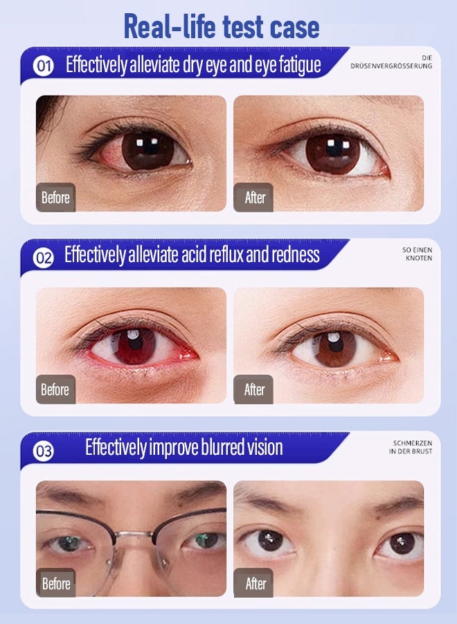 HFH-Instant eye correction for clear vision，Redness Relief Eye Drops, Eye Drops - Image 3