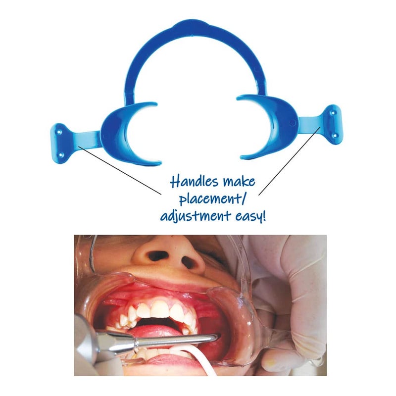 WMD® (worldmedident) Dental Cheek Retractor Lip Mouth Opener Teeth Whitening Retractor C Shaped with Handle Qty.1 - Image 2