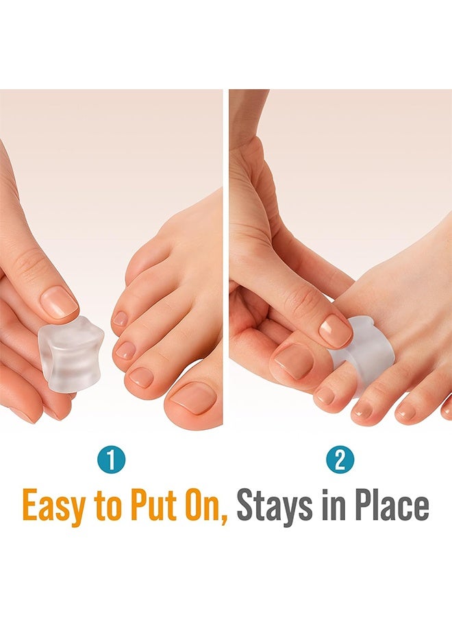 واي جيه فواصل أصابع القدم المكونة من 4 أجزاء، فاصل أصابع القدم مع ملحق الجل لعلاج البروزات، لتصحيح القدم المعوجة، فاصل أصابع القدم للعناية بالقدم - Image 4