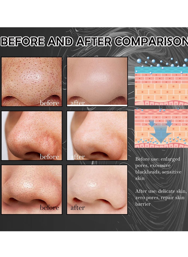 Deep Cleansing, Blackhead Removal, Gentle Pore Tightening, Strawberry Nose Mask