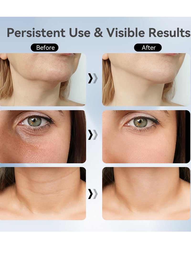 عام جهاز تدليك الوجه والرقبة، جهاز تدليك الوجه المحمول 3 في 1، أداة نحت الوجه، جهاز منزلي للعناية بالبشرة، أبيض - Image 5