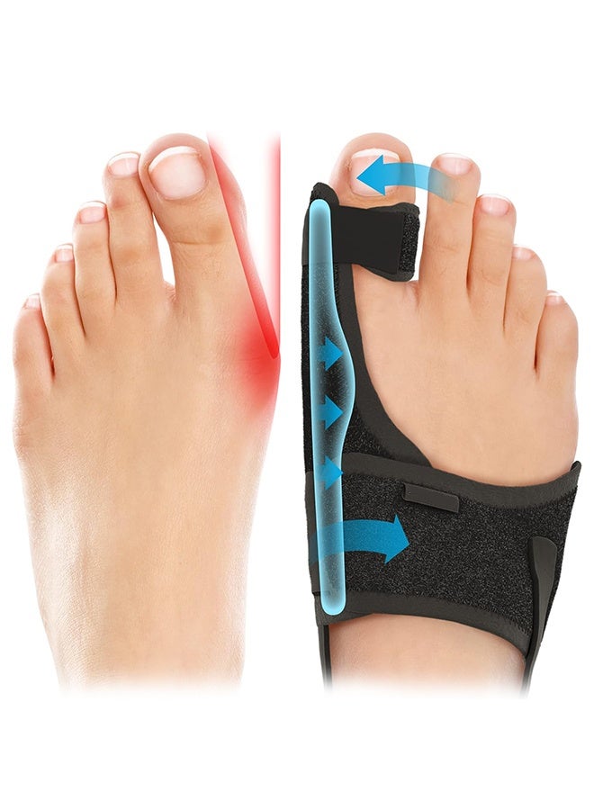 2-Pack Bunion Corrector for Women & Men, Orthopedic Bunion Splint for Hallux Valgus Pain Relief, Big Toe Separator, Adjustable Day/Night Support, Comfortable Hammer Toe Straightener - Image 1