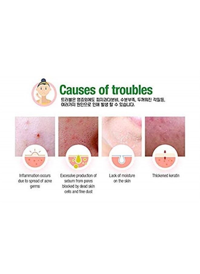 Acropass - [Acropass] Trouble Cure Plus (9 acne patches, 9 cleansing pads and 15 daycare patches) Instant Acne Pimple Patch with Dissolving Hyaluronic Acid Micro Structure - Image 1