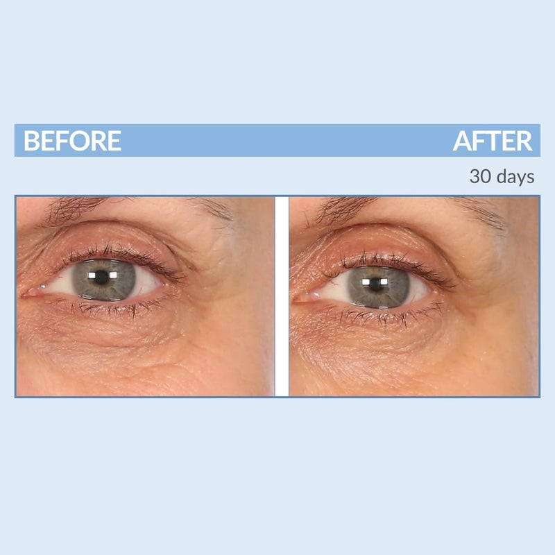 Serious Skincare - EYETALITY Morning Under Eye Cream for Dark Circles & Puffiness, Anti-Aging Daily Wrinkle Cream, Line Smoothing Skin Care Treatment for Women and Men - Coffee Bean Extract 0.5 oz - Image 3