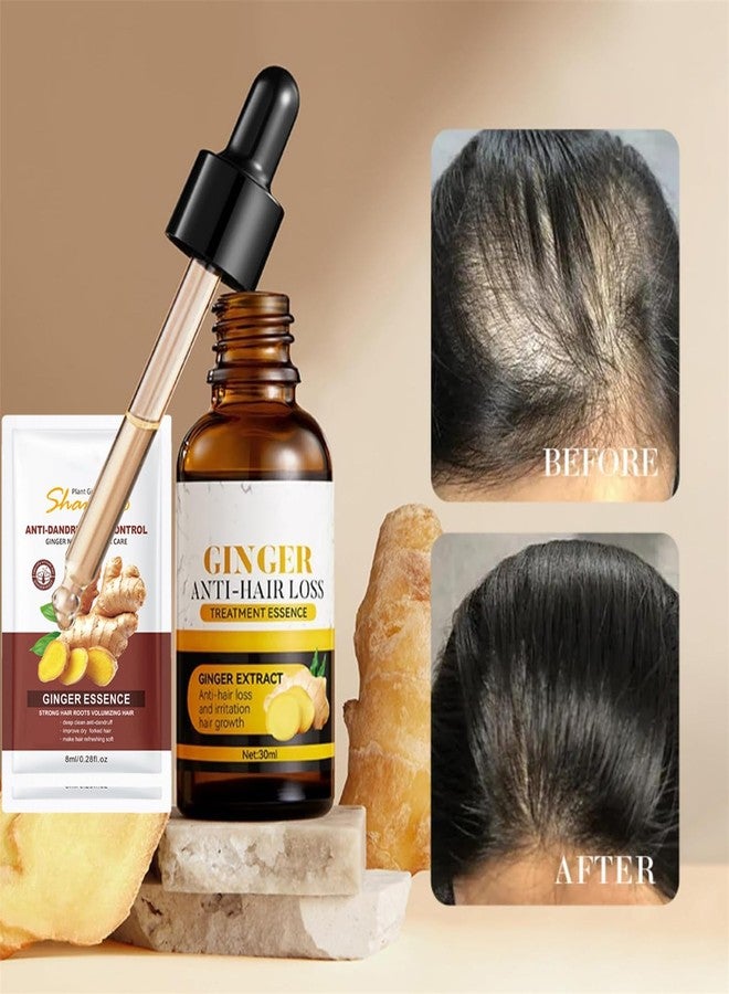 Cappuvini Ginger Anti-Hair Loss Oil and Shampoo, Hair Growth Serum Set, Ginger Extract Anti-Hair Loss Treatment Essence Set for Thicker, Stronger, Longer for Men and Women (1) - Image 2