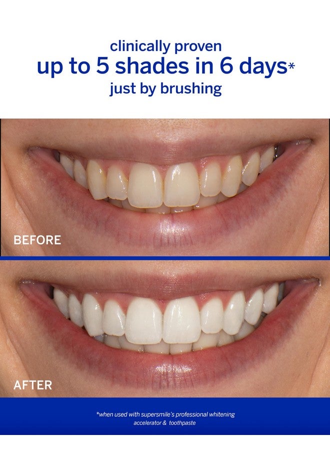 سوبر سمايل مُسرِّع تبييض الأسنان الاحترافي من سوبر سمايل - تبييض قوي بدون حساسية - آمن وفعال على ترميمات الأسنان (3.6 أونصة) - Image 2