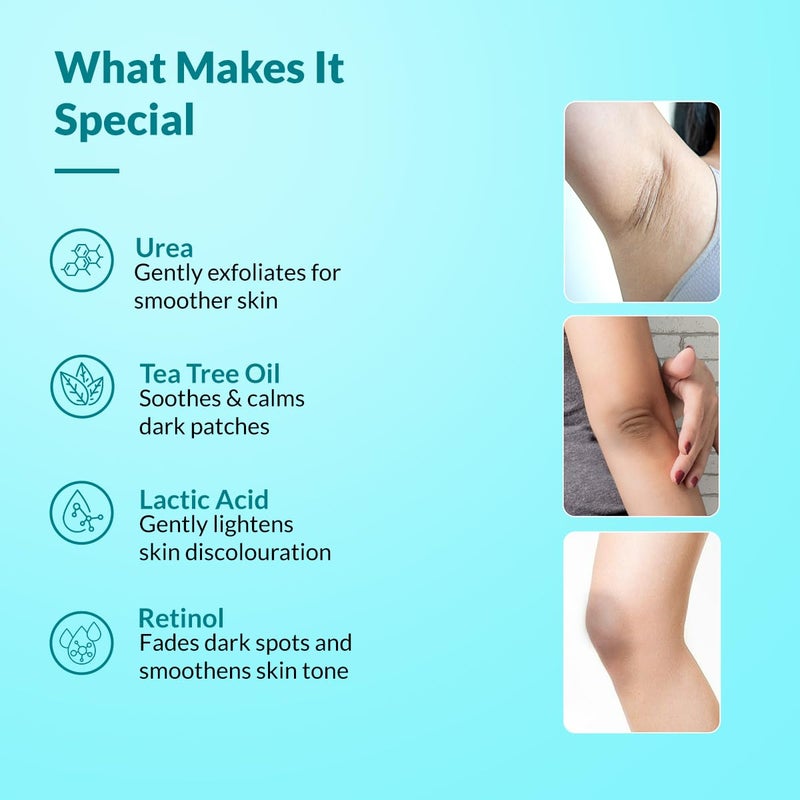 FIXDERMA كريم FIXDERMA Nigrifix لمرض الأكثوز الأسود مع حمض اللاكتيك | كريم ريتينول مختبر من قبل أطباء الجلد | مفيد للأجزاء الداكنة من الجسم مثل الرقبة والكاحلين والإبطين والمرفقين – 3.52 أونصة سائلة - Image 4