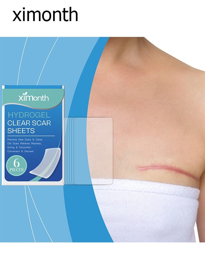 Ximonth Advanced Clear Silicone Scar Sheets - Medical Grade Silicone Strips (1.57" x 2.76") Scar Treatment And Prevention For Surgical, Burn, Body, Hypertrophic And Keloid Scar Treatment - 6 Clear Sheets - Image 3