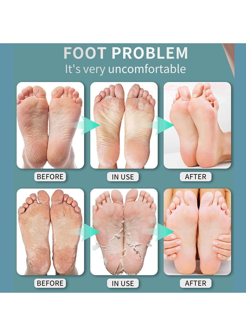 DubaiGallery 30ml Foot Treatment Spray, Foot Spray Foot Odor Eliminator for Shoes Foot, Plant Extract Odor Eliminator Gentle Peeling Foot Treatment Spray - Image 3