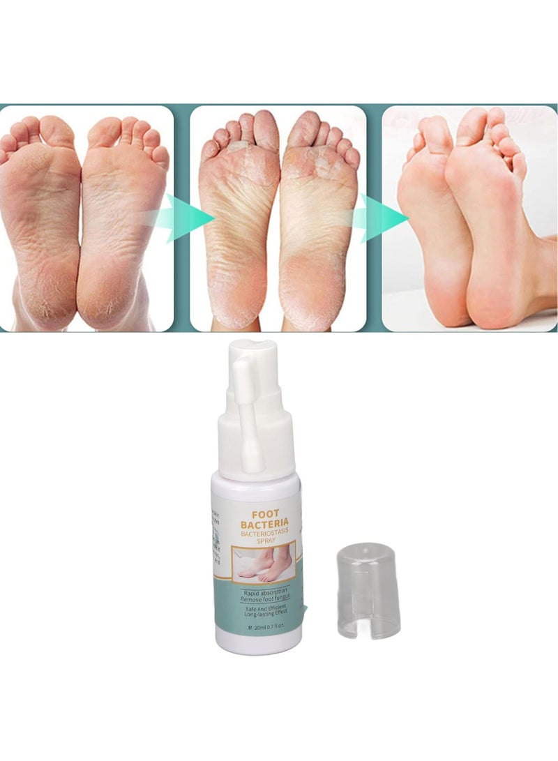 DubaiGallery 30ml Foot Treatment Spray, Foot Spray Foot Odor Eliminator for Shoes Foot, Plant Extract Odor Eliminator Gentle Peeling Foot Treatment Spray - Image 4