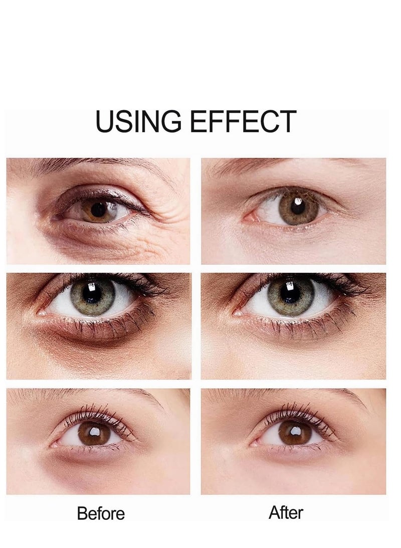 OCHEAL Anti Wrinkle Eye Cream, Eye Puffiness Cream with Electric Massager, Hydrating and Firming Eye Serum Creams, Smooth & Tighten Puffiness Wrinkles Fine Lines, Anti Aging Eye Cream for All Skin Types 20g - Image 5