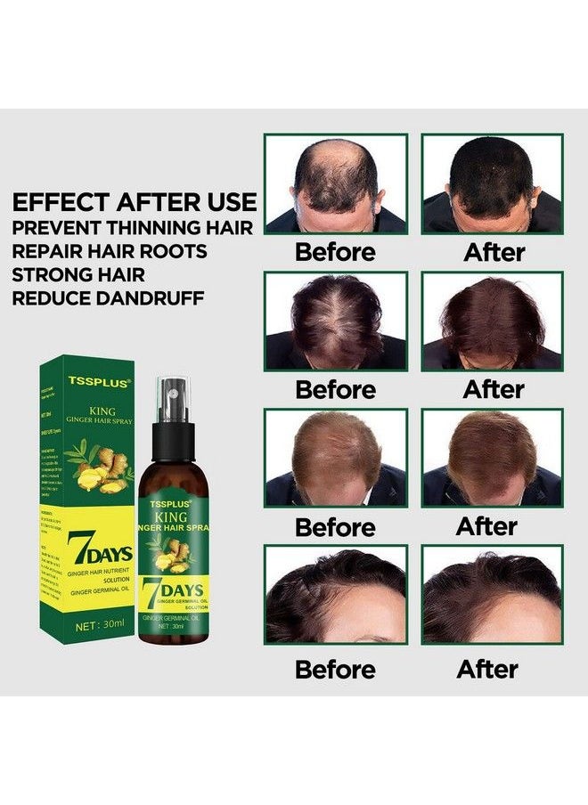 TSSPLUS - New Ginger Hair Growth Essential Sprayhair Growth Serumhair Growth Treatment Hair Serum Anti Hair Loss Thinning Balding Repairs Hair Follicles Promotes Thicker Stronger Hair And Promotes Hair Regrowth - Image 1