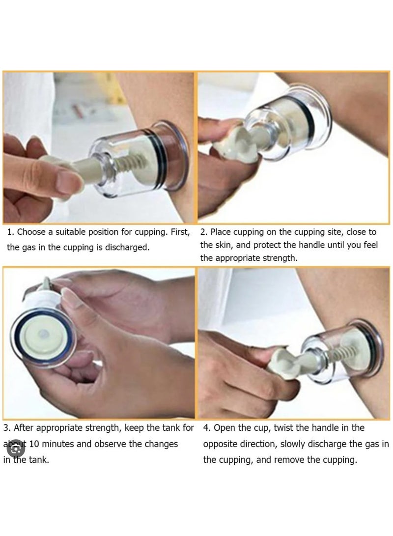 Generic Set of Chinese Body Cup Vacuum Twist Suction Cupping Device Transparent Cup Pump Professional Effective - Image 4