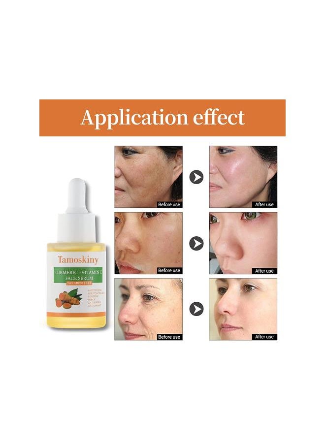 Generic - Turmeric and Vitamin C Face Serum, Turmeric Serum for Dark Spots, Anti Aging Serum, Moisturizing Face Serum for Dull & Dry Skin, Smoothing, Repair Skin Suitable for All Skin Types - 1oz/30ml - Image 1