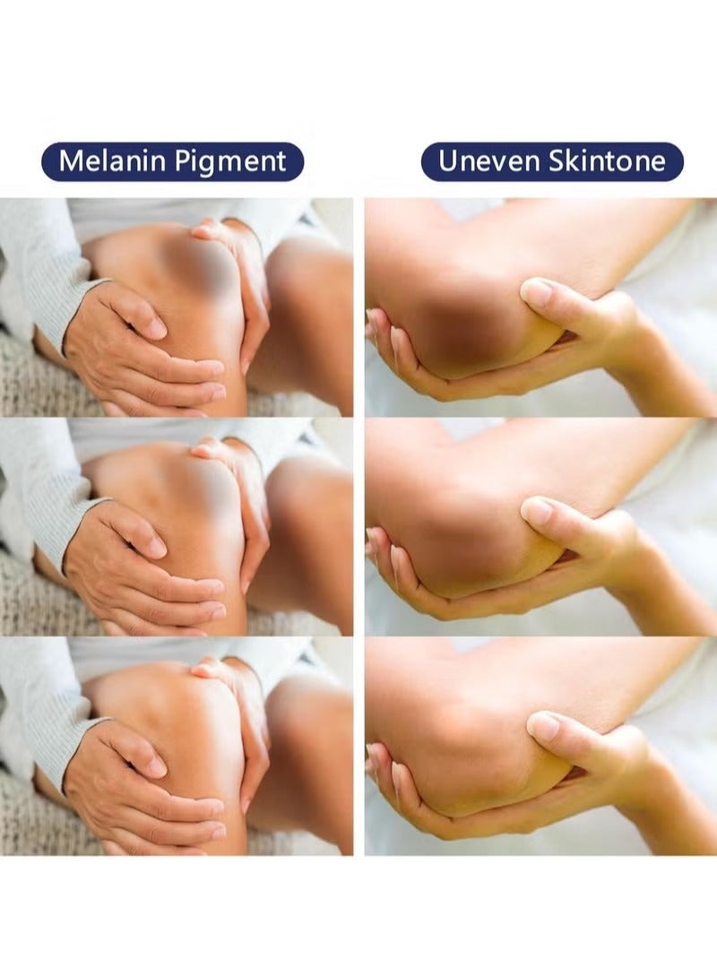 OceAura Intimate Areas Skin Lightening Cream Bleaching Cream For Body Sensitive Intimate Area, Private Parts, Underarm, Knees, Elbows, Inner Thigh, Bikini Areas, Bikini Line, Natural Skin Whitening. - Image 2