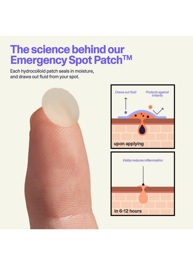 Curology - Curology Emergency Spot Pimple Patches for Face, Hydrocolloid Pimple Patches Fast-Acting Support, Spot Concealing and Oil Absorbing, 40 Count - Image 1