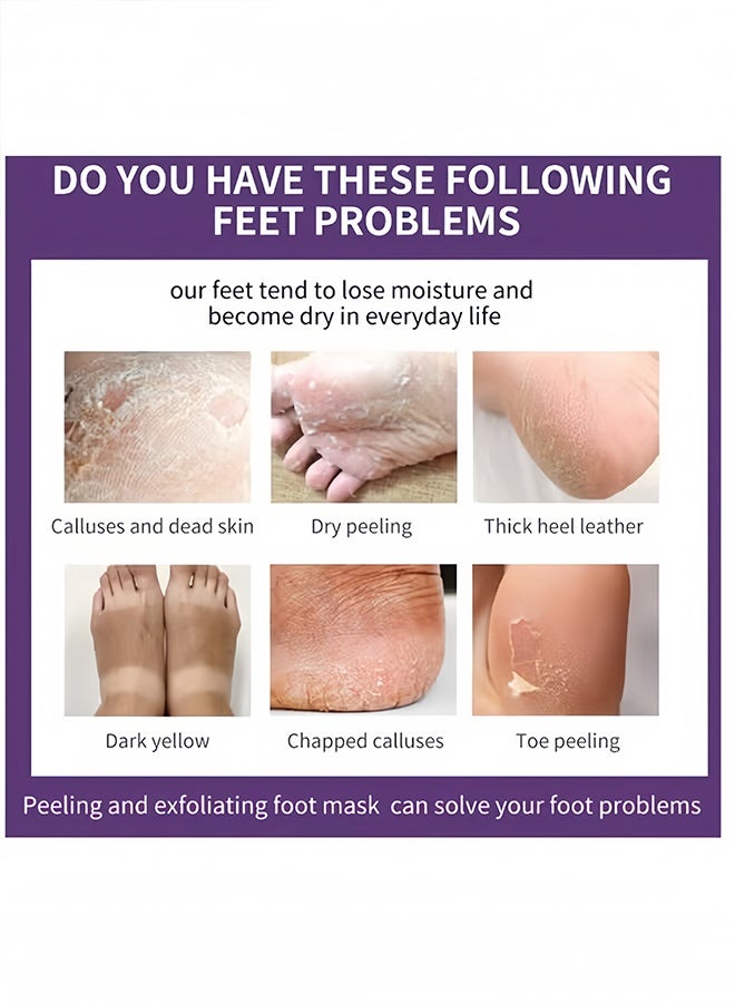 APPTI Lavender VC Exfoliating Foot Peel Mask, Dead Skin Removing Callus Softening Foot Treatment Mask, Moisturizing Repair Rough Dry Feet Skin Care Foot Mask,40g*2 Pairs - Image 2